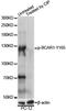 BCAR1 Scaffold Protein, Cas Family Member antibody, LS-C750619, Lifespan Biosciences, Western Blot image 