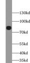 ArfGAP With Coiled-Coil, Ankyrin Repeat And PH Domains 1 antibody, FNab00069, FineTest, Western Blot image 