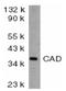 DNA Fragmentation Factor Subunit Beta antibody, AP05811PU-N, Origene, Western Blot image 