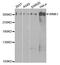 WNK1 antibody, LS-C332174, Lifespan Biosciences, Western Blot image 