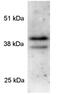 PRKC apoptosis WT1 regulator protein antibody, GTX82874, GeneTex, Western Blot image 