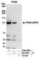 Poly(A) Specific Ribonuclease Subunit PAN2 antibody, A304-882A, Bethyl Labs, Immunoprecipitation image 