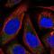 Tachykinin 3 antibody, NBP1-92178, Novus Biologicals, Immunofluorescence image 