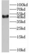 BMI1 Proto-Oncogene, Polycomb Ring Finger antibody, FNab00913, FineTest, Western Blot image 