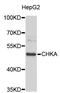Choline Kinase Alpha antibody, STJ23127, St John