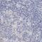 Spermatogenesis Associated 18 antibody, NBP1-81984, Novus Biologicals, Immunohistochemistry paraffin image 