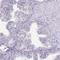 Dynein Axonemal Heavy Chain 9 antibody, HPA052641, Atlas Antibodies, Immunohistochemistry paraffin image 