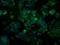 Aldehyde Dehydrogenase 2 Family Member antibody, NBP2-02102, Novus Biologicals, Immunocytochemistry image 