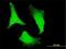 40S ribosomal protein S2 antibody, H00006187-M01, Novus Biologicals, Immunocytochemistry image 
