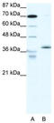 Nuclear receptor subfamily 2 group F member 6 antibody, TA330217, Origene, Western Blot image 