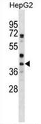 Protein Wnt-6 antibody, AP54569PU-N, Origene, Western Blot image 