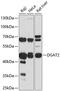 Diacylglycerol O-Acyltransferase 2 antibody, 15-252, ProSci, Western Blot image 