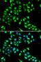 TRNA Methyltransferase 9B (Putative) antibody, PA5-77162, Invitrogen Antibodies, Immunofluorescence image 