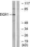 DEAQ-Box RNA Dependent ATPase 1 antibody, AP33265PU-N, Origene, Western Blot image 