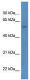 Zinc Finger Protein 692 antibody, TA331880, Origene, Western Blot image 