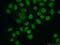 F-box only protein 18 antibody, 14275-1-AP, Proteintech Group, Immunofluorescence image 