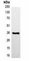 Nanos C2HC-Type Zinc Finger 2 antibody, orb75008, Biorbyt, Immunoprecipitation image 