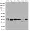 Major Histocompatibility Complex, Class II, DR Beta 5 antibody, M01789, Boster Biological Technology, Western Blot image 