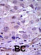 Ret Proto-Oncogene antibody, abx033596, Abbexa, Immunohistochemistry paraffin image 