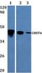 Carbohydrate Sulfotransferase 6 antibody, GTX66796, GeneTex, Western Blot image 