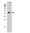 Ly1 Antibody Reactive antibody, A09986-1, Boster Biological Technology, Western Blot image 