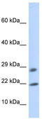 OCIA Domain Containing 2 antibody, TA338837, Origene, Western Blot image 