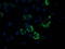 Pyruvate Dehydrogenase E1 Alpha 1 Subunit antibody, CF502696, Origene, Immunofluorescence image 