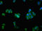 ATPase Sarcoplasmic/Endoplasmic Reticulum Ca2+ Transporting 1 antibody, orb401444, Biorbyt, Immunofluorescence image 