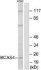 Breast Carcinoma Amplified Sequence 4 antibody, TA313274, Origene, Western Blot image 