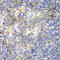 Zeta Chain Of T Cell Receptor Associated Protein Kinase 70 antibody, A2195, ABclonal Technology, Immunohistochemistry paraffin image 