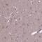 Family With Sequence Similarity 114 Member A1 antibody, HPA069701, Atlas Antibodies, Immunohistochemistry frozen image 