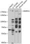 Multimerin 1 antibody, 22-384, ProSci, Western Blot image 
