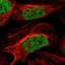 Zinc Finger Protein 532 antibody, HPA015322, Atlas Antibodies, Immunofluorescence image 