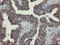 Phosphoacetylglucosamine mutase antibody, LS-C174053, Lifespan Biosciences, Immunohistochemistry paraffin image 