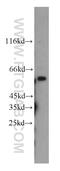 c-Myc antibody, 10828-1-AP, Proteintech Group, Western Blot image 