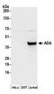 ADA1 antibody, A305-182A, Bethyl Labs, Western Blot image 