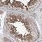 SOGA Family Member 3 antibody, HPA035389, Atlas Antibodies, Immunohistochemistry frozen image 