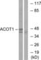 Acyl-CoA Thioesterase 1 antibody, LS-C119691, Lifespan Biosciences, Western Blot image 