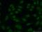 Regulator Of Telomere Elongation Helicase 1 antibody, 25337-1-AP, Proteintech Group, Immunofluorescence image 