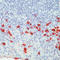 Ig lambda-1 chain C regions antibody, LS-C87577, Lifespan Biosciences, Immunohistochemistry paraffin image 