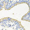 Striatin-3 antibody, LS-C335701, Lifespan Biosciences, Immunohistochemistry paraffin image 