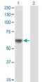 ATPase H+ Transporting Accessory Protein 1 antibody, H00000537-M02, Novus Biologicals, Western Blot image 