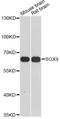SRY-Box 9 antibody, abx126625, Abbexa, Western Blot image 