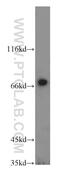 RAB11 Family Interacting Protein 5 antibody, 14594-1-AP, Proteintech Group, Western Blot image 