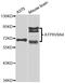 ATPase H+ Transporting V0 Subunit A4 antibody, LS-C349260, Lifespan Biosciences, Western Blot image 