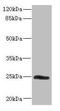 Small Nuclear Ribonucleoprotein Polypeptide B2 antibody, orb41302, Biorbyt, Western Blot image 