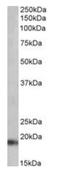 Natriuretic Peptide A antibody, orb125226, Biorbyt, Western Blot image 