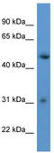 Rhophilin Associated Tail Protein 1 Like antibody, TA342988, Origene, Western Blot image 