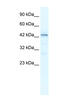 SP140 Nuclear Body Protein Like antibody, MBS835440, MyBioSource, Western Blot image 