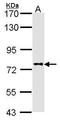 Dipeptidyl Peptidase 8 antibody, TA308193, Origene, Western Blot image 